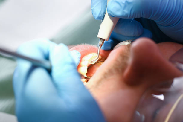 Best After-Hours Dental Trauma Care in Nicoma Park, OK