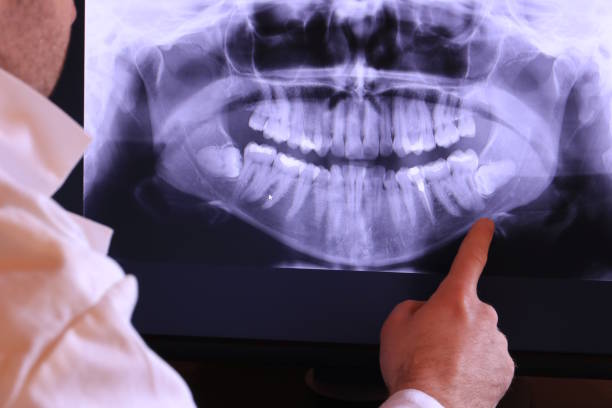 Best Emergency Root Canal Treatment in Nicoma Park, OK