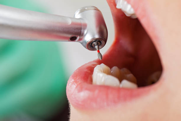 Best Urgent Care for Lost Fillings or Crowns in Nicoma Park, OK